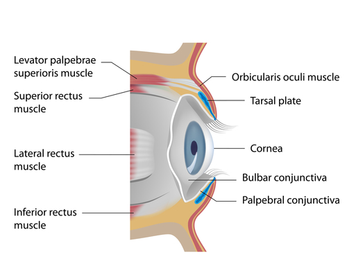 Can I lose a Contact Lens in my Eye?